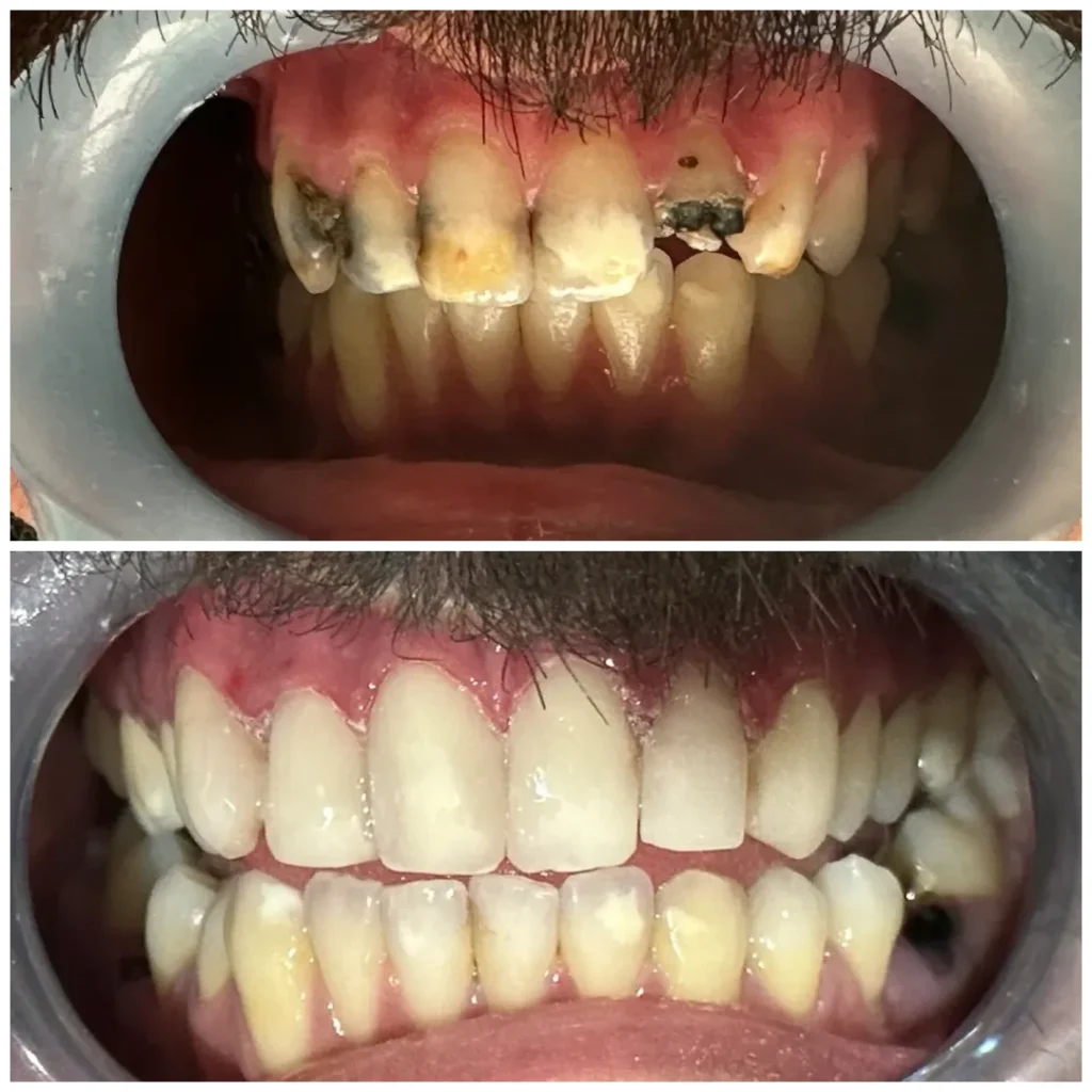 Cosmetic Dental Services